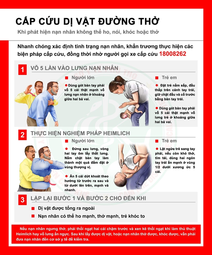 Vỡ dạ dày vì người thân thực hiện ép bụng đẩy dị vật ra sai cách- Ảnh 2. Vỡ dạ dày vì người thân thực hiện ép bụng đẩy dị vật ra sai cách- Ảnh 2.