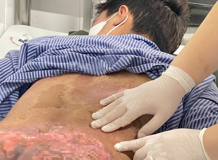 Chữa ngứa bằng hơn 40 con kiến ba khoang, nam thanh niên nhập viện- Ảnh 1. Chữa ngứa bằng hơn 40 con kiến ba khoang, nam thanh niên nhập viện- Ảnh 1.