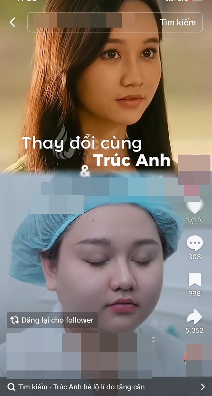 Trúc Anh "Mắt biếc" đi thẩm mỹ?- Ảnh 2. Trúc Anh "Mắt biếc" đi thẩm mỹ?- Ảnh 2.