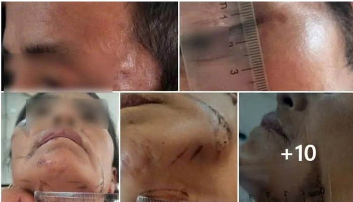 Bị đánh đập, treo lên cây do bị nghi làm bùa ngải khiến người khác tử vong- Ảnh 1. Bị đánh đập, treo lên cây do bị nghi làm bùa ngải khiến người khác tử vong- Ảnh 1.