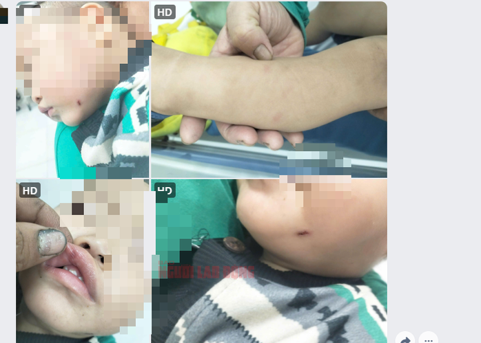 Bảo mẫu hành hạ trẻ ở Quảng Nam: Phẫn nộ tột độ, không thể để tái diễn!- Ảnh 2. Bảo mẫu hành hạ trẻ ở Quảng Nam: Phẫn nộ tột độ, không thể để tái diễn!- Ảnh 2.