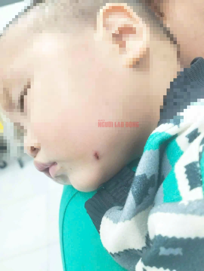 Nữ giáo viên đánh trẻ dã man: Kết quả điều tra ban đầu từ Công an Quảng Nam- Ảnh 8. Nữ giáo viên đánh trẻ dã man: Kết quả điều tra ban đầu từ Công an Quảng Nam- Ảnh 8.