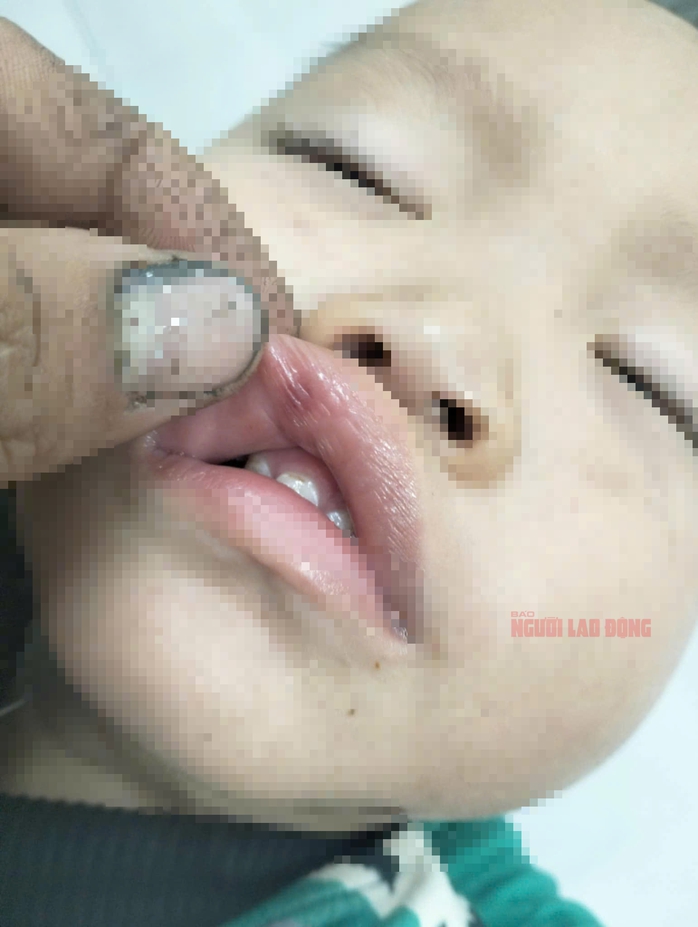 Nữ giáo viên đánh trẻ dã man: Kết quả điều tra ban đầu từ Công an Quảng Nam- Ảnh 7. Nữ giáo viên đánh trẻ dã man: Kết quả điều tra ban đầu từ Công an Quảng Nam- Ảnh 7.