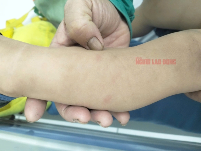 Nữ giáo viên đánh trẻ dã man: Kết quả điều tra ban đầu từ Công an Quảng Nam- Ảnh 5. Nữ giáo viên đánh trẻ dã man: Kết quả điều tra ban đầu từ Công an Quảng Nam- Ảnh 5.