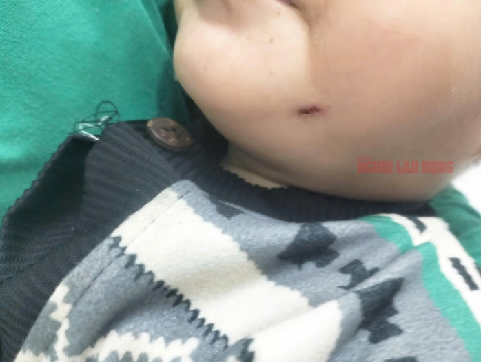 Nữ giáo viên đánh trẻ dã man: Kết quả điều tra ban đầu từ Công an Quảng Nam- Ảnh 6. Nữ giáo viên đánh trẻ dã man: Kết quả điều tra ban đầu từ Công an Quảng Nam- Ảnh 6.