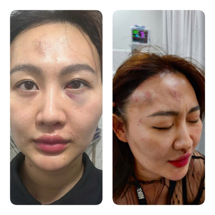 Công an TP HCM bắt thanh niên tấn công bạn gái ở quán cà phê- Ảnh 1. Công an TP HCM bắt thanh niên tấn công bạn gái ở quán cà phê- Ảnh 1.