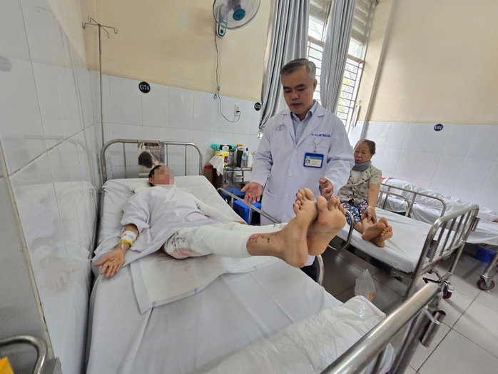 Một bệnh nhân bị phỏng cồn y tế đang điều trị tại Bệnh viện Chợ Rẫy Một bệnh nhân bị phỏng cồn y tế đang điều trị tại Bệnh viện Chợ Rẫy