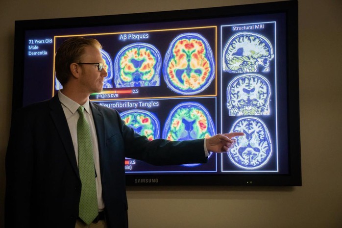 Bước tiến mới về điều trị bệnh Alzheimer- Ảnh 1. Bước tiến mới về điều trị bệnh Alzheimer- Ảnh 1.