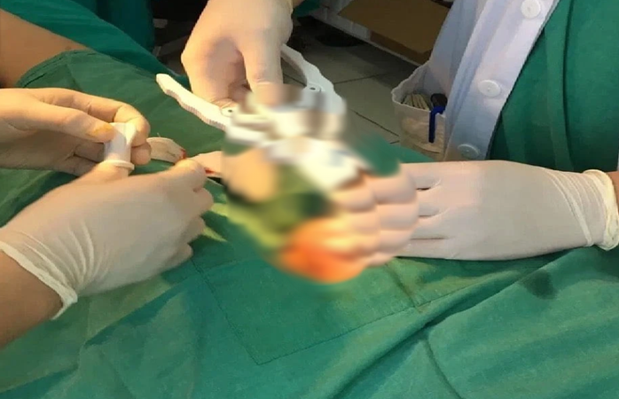 Tưởng bệnh tình dục phổ biến, ai ngờ là ung thư dương vật- Ảnh 1. Tưởng bệnh tình dục phổ biến, ai ngờ là ung thư dương vật- Ảnh 1.