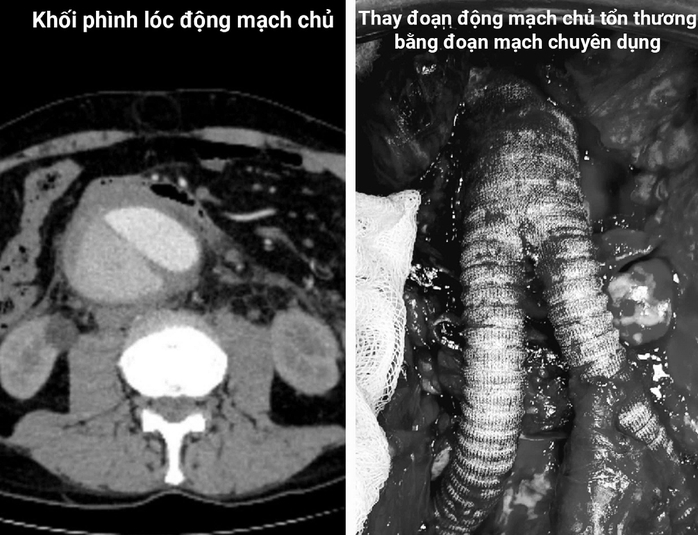 Du khách nước ngoài nguy kịch, bác sĩ Việt cứu sống ngoạn mục - Ảnh 1.