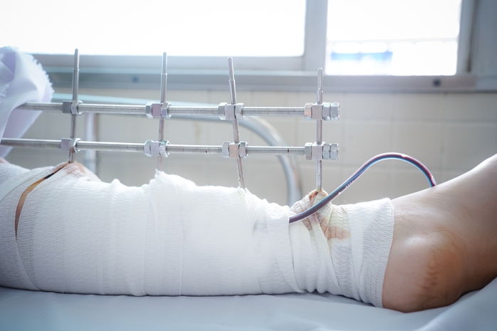 Bác sĩ chạy đua cứu cô gái bị tường đè - Ảnh 2.