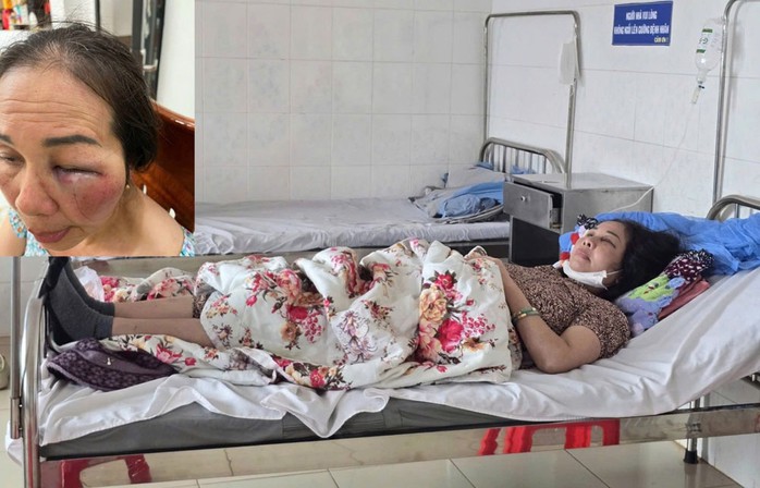 Làm rõ việc tiểu thương tố bị hành hung- Ảnh 1. Làm rõ việc tiểu thương tố bị hành hung- Ảnh 1.