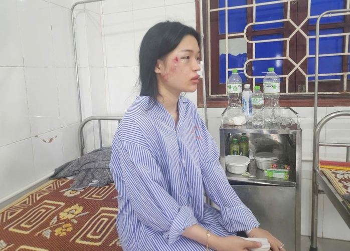 Nạn nhân vụ xe khách lật ở Hà Tĩnh: “Khung cảnh lúc đó rất hỗn loạn và kinh hoàng”- Ảnh 1. Nạn nhân vụ xe khách lật ở Hà Tĩnh: “Khung cảnh lúc đó rất hỗn loạn và kinh hoàng”- Ảnh 1.