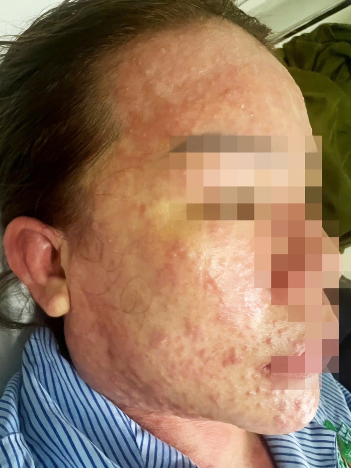 Một phụ nữ suýt chết khi uống collagen, thuốc giảm cân mua trên mạng- Ảnh 1. Một phụ nữ suýt chết khi uống collagen, thuốc giảm cân mua trên mạng- Ảnh 1.