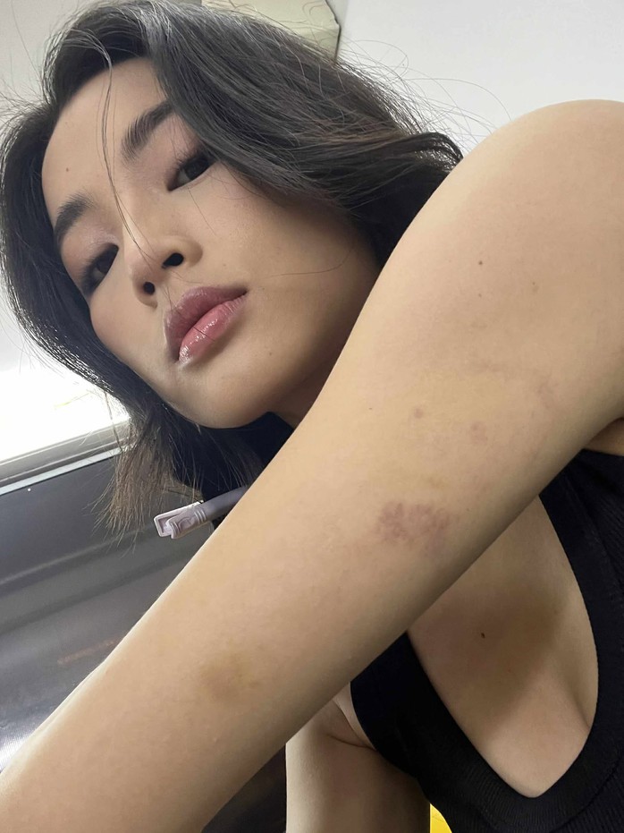 Otis kể về cảnh "giường chiếu" với Thủy Tiên, Lan Thy - Ảnh 3.