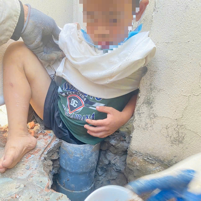 Cháu bé 5 tuổi gặp nạn hy hữu - Ảnh 1. Cháu bé 5 tuổi gặp nạn hy hữu - Ảnh 1.