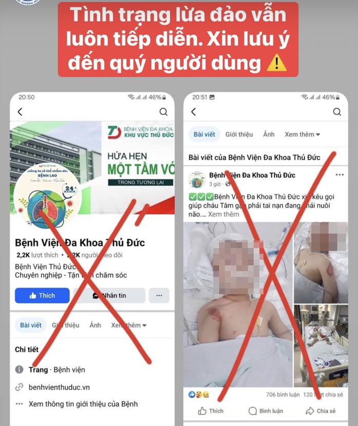 Dựng chuyện cháu bé gặp tai nạn thương tâm để kêu gọi từ thiện - Ảnh 1.