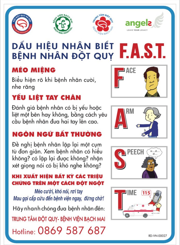 Nhiều người đột quỵ vì xem nhẹ dấu hiệu này - Ảnh 2.