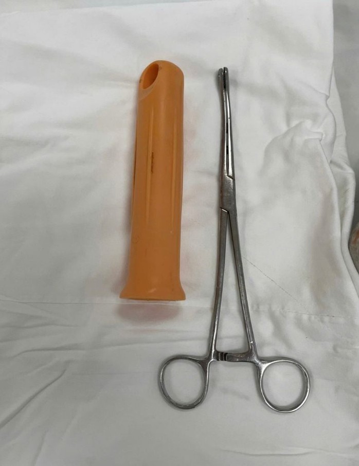 Cán cây lau nhà nằm trong trực tràn nam thanh niên 23 tuổi - Ảnh 1.