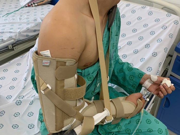 Chơi vật tay với bạn, nam sinh bị gãy xương- Ảnh 1.