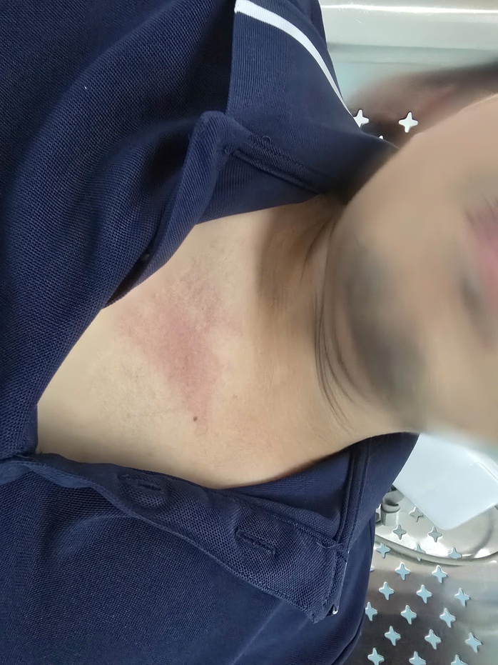 Phóng viên VOV bị còng tay khi tác nghiệp, chủ tịch phường An Phú Đông nói gì? - Ảnh 2.