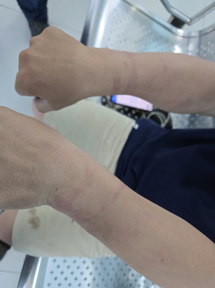 Phóng viên VOV bị còng tay khi tác nghiệp, chủ tịch phường An Phú Đông nói gì? - Ảnh 4.