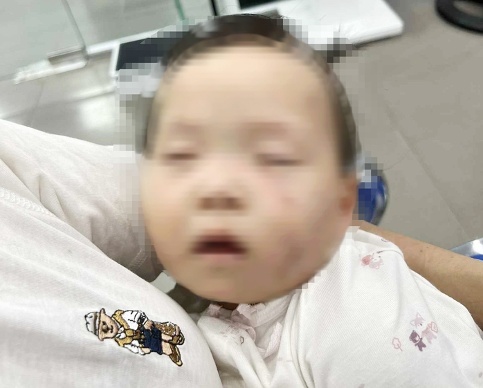 Tạm giữ nữ giáo viên trong vụ bé gái có nhiều vết bầm tím chi chít trên mặt - Ảnh 1.
