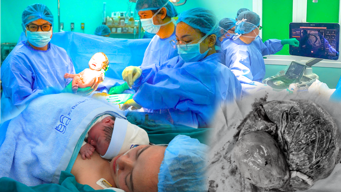 Cứu sống thai nhi mắc khối u nhau thai hiếm gặp - Ảnh 1.
