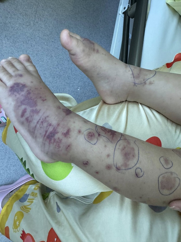 Chuy&ecirc;n gia cảnh b&aacute;o về một căn bệnh nguy hiểm, l&acirc;y lan nhanh, tỉ lệ tử vong cao - Ảnh 1.