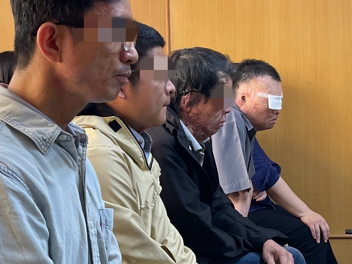 Đ&atilde; "t&igrave;m" được kẻ tạt axit 4 người ở Khu chế xuất T&acirc;n Thuận - Ảnh 1.