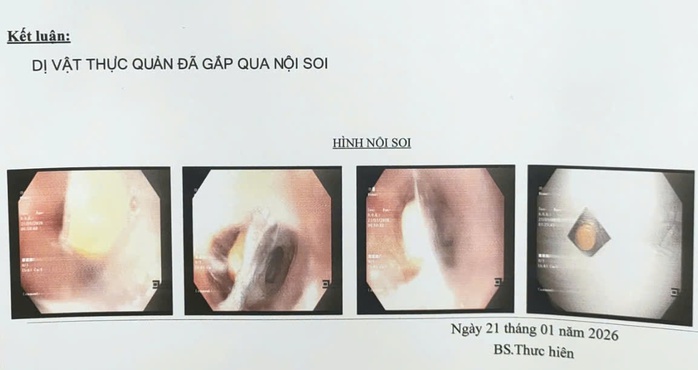 Bác sĩ cảnh báo một hiện tượng nguy hiểm ở người già - Ảnh 1.