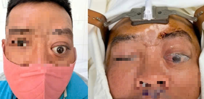 Một người đ&agrave;n &ocirc;ng mắc bệnh hiếm, 20 năm mới gặp 2 ca - Ảnh 1.