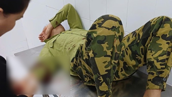 Xử l&yacute; nghi&ecirc;m đối tượng ch&eacute;m nh&acirc;n vi&ecirc;n bảo vệ rừng tại Đồng Nai - Ảnh 3.