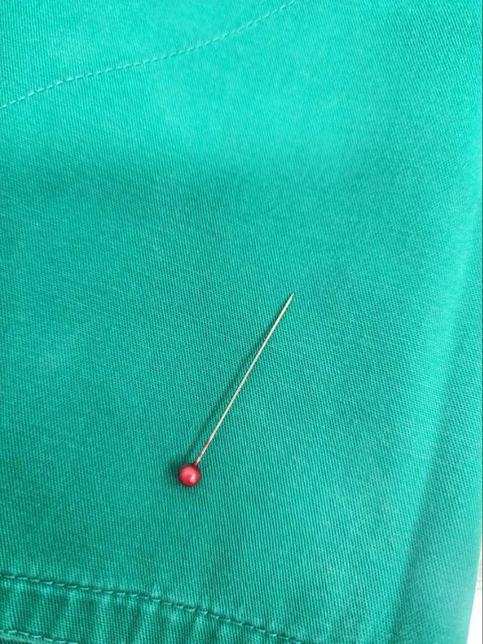 Kim may đồ mắc trong phế quản b&eacute; 13 th&aacute;ng tuổi, - Ảnh 1.