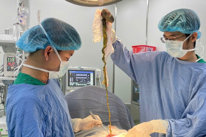 B&eacute; trai 6 tuổi phải phẫu thuật v&igrave; ăn t&oacute;c - cảnh b&aacute;o bệnh hiếm gặp - Ảnh 1.