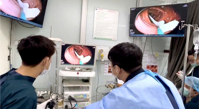 S&aacute;n d&acirc;y d&agrave;i gần 1 m&eacute;t "ngọ nguậy" trong đại tr&agrave;ng người đ&agrave;n &ocirc;ng th&iacute;ch ăn đồ t&aacute;i - Ảnh 1.