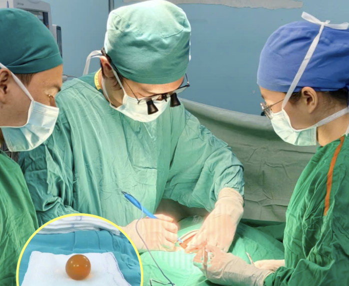 Bác sĩ cảnh báo nguy cơ Từ hạt đồ chơi gây tắc ruột ở trẻ em - Ảnh 1. Bác sĩ cảnh báo nguy cơ Từ hạt đồ chơi gây tắc ruột ở trẻ em - Ảnh 1.