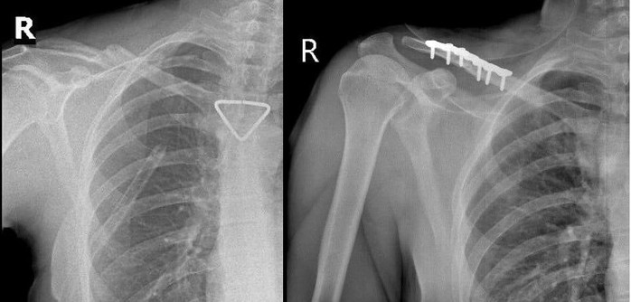 Th&ecirc;m 1 du kh&aacute;ch người Nga được b&aacute;c sĩ cấp cứu kịp thời - Ảnh 2.