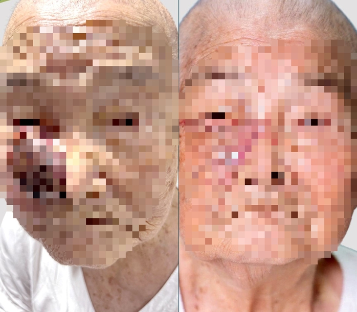 Kỳ t&iacute;ch mang lại nụ cười cho những bệnh nh&acirc;n ngh&egrave;o - Ảnh 5.