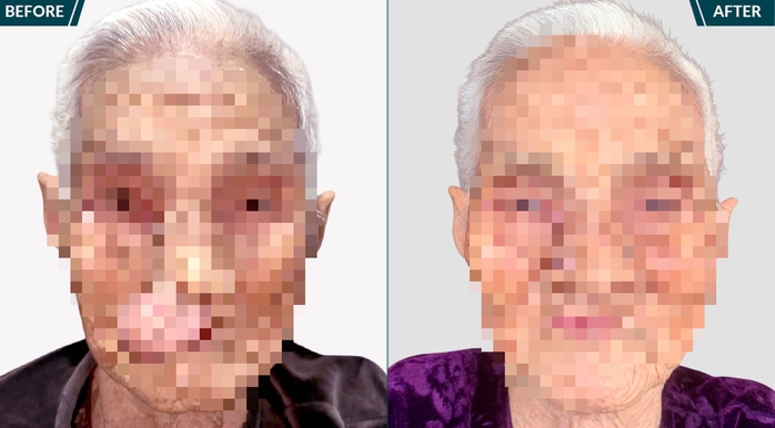 Kỳ t&iacute;ch mang lại nụ cười cho những bệnh nh&acirc;n ngh&egrave;o - Ảnh 3.