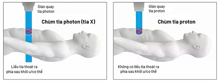 B&ecirc;̣nh vi&ecirc;̣n T&acirc;m Anh mua &ldquo;si&ecirc;u máy ng&agrave;n tỉ&rdquo; xạ trị ung thư ngay T&ecirc;́t Nguy&ecirc;n đán - Ảnh 3.