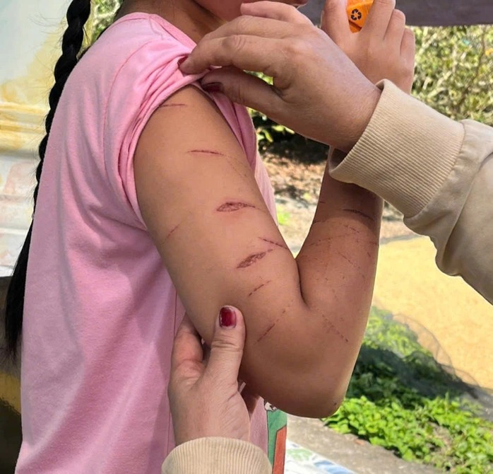 Vụ nữ sinh bị chị họ g&acirc;y thương t&iacute;ch: Giao "thủ phạm" cho nh&agrave; trường, gia đ&igrave;nh quản l&yacute; - Ảnh 1.