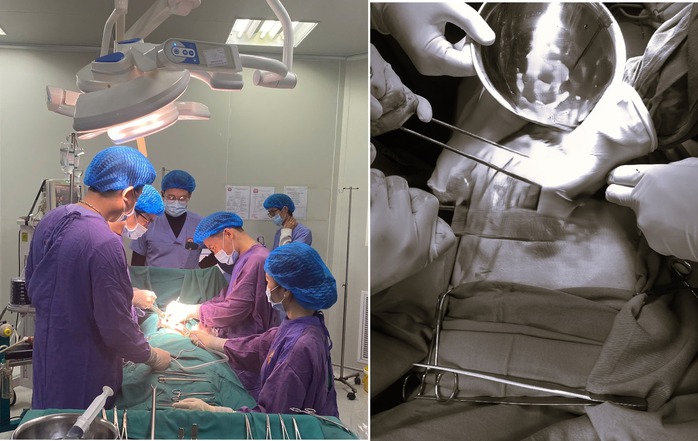 Dọn nh&agrave; đ&oacute;n Tết , người đ&agrave;n &ocirc;ng ng&atilde; từ tr&ecirc;n cao , nguy kịch Đa chấn thương - Ảnh 1.