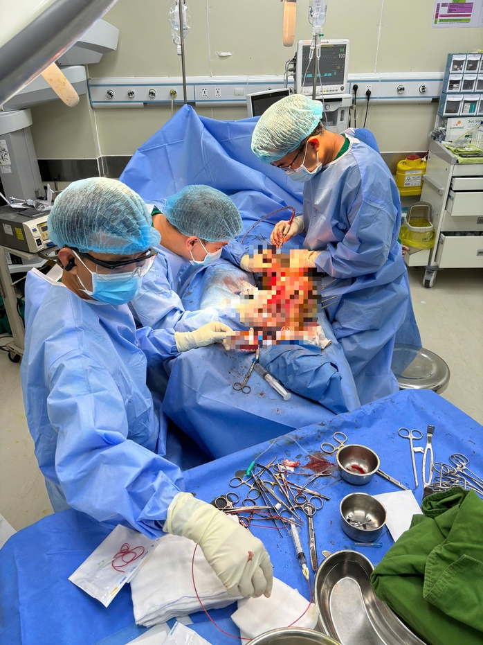 22 Giờ phẫu thuật hồi sinh ch&acirc;n cho thầy gi&aacute;o Campuchia tại TPHCM - Ảnh 1.