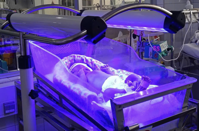 30 giờ sau sinh, bé sơ sinh phải thay máu vì vàng da sơ sinh nặng - Ảnh 1.