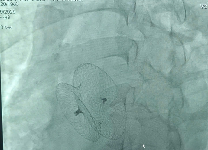 Hồi hộp, tim đập nhanh k&eacute;o d&agrave;i, ph&aacute;t hiện bệnh tim nguy hiểm - Ảnh 1.