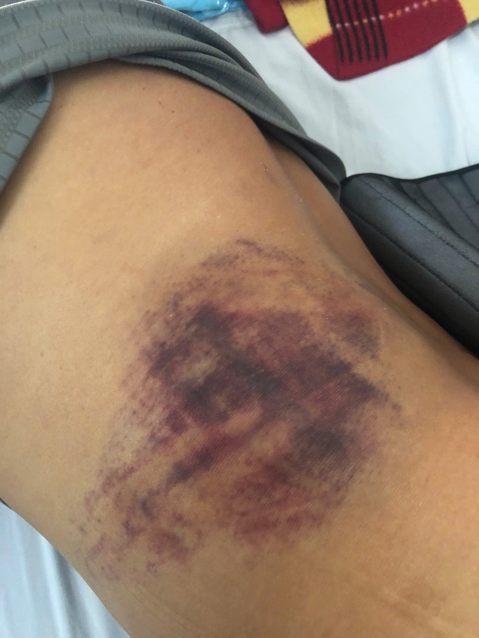 - Ảnh 3. - Ảnh 3.