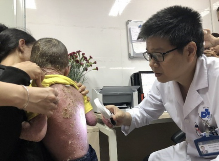 Đề xuất BHYT chi trả 50&ndash;70% thuốc sinh học điều trị vảy nến - Ảnh 2.