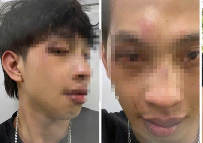 - Ảnh 2. - Ảnh 2.