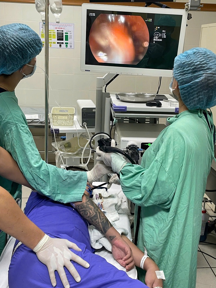 Người đàn ông nuốt cùng lúc 3 bàn chải đánh răng vào bụng - Ảnh 3.